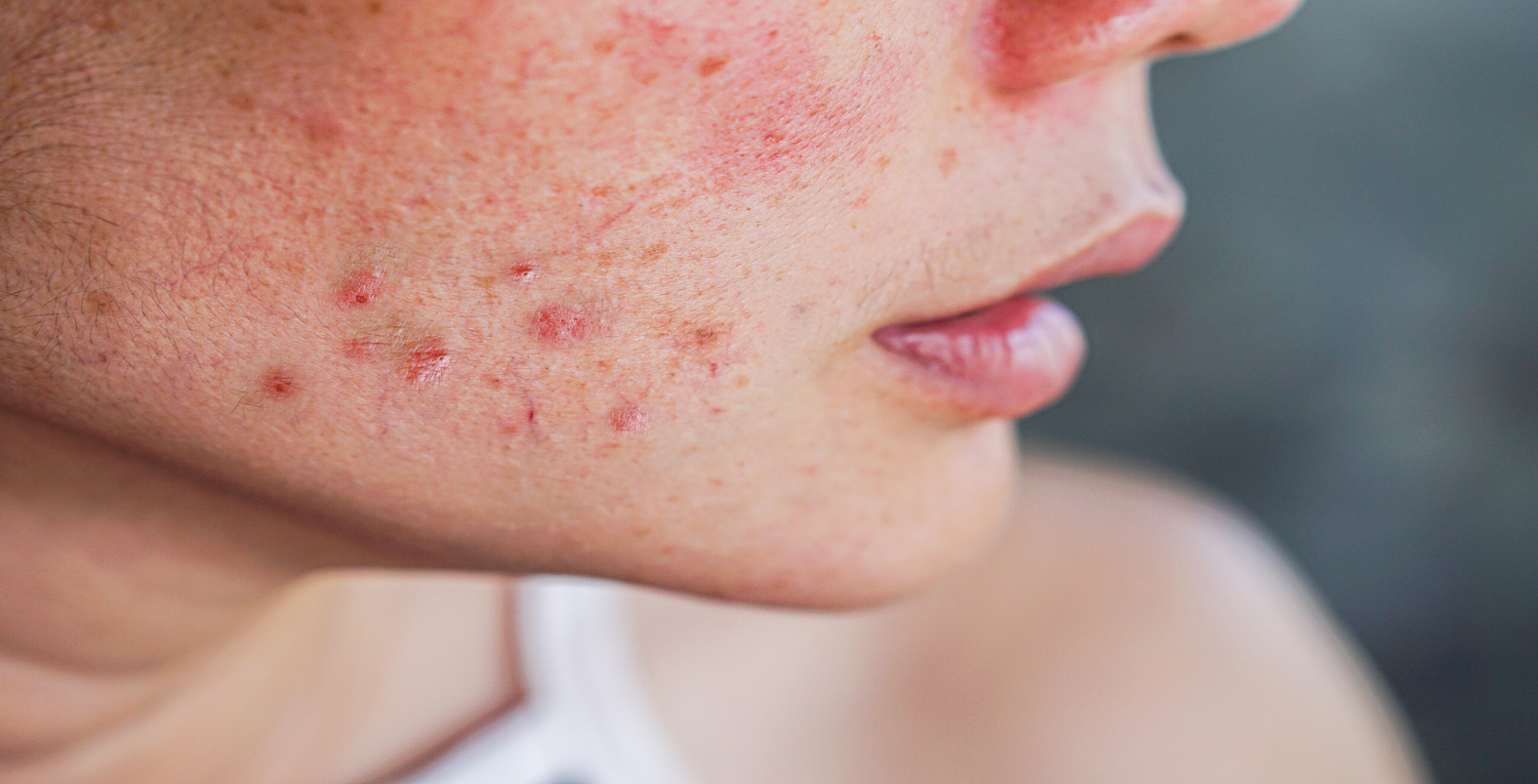 Image depicting a person with sensitive skin